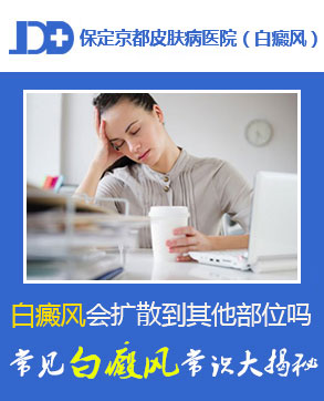保定白癜风医院哪家好
