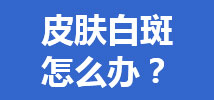 皮肤白斑 怎么办？
